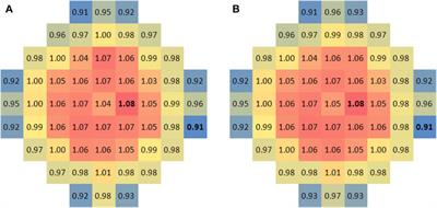 Experimental Research of Flow Distribution at Reactor Core Inlet of ACP100